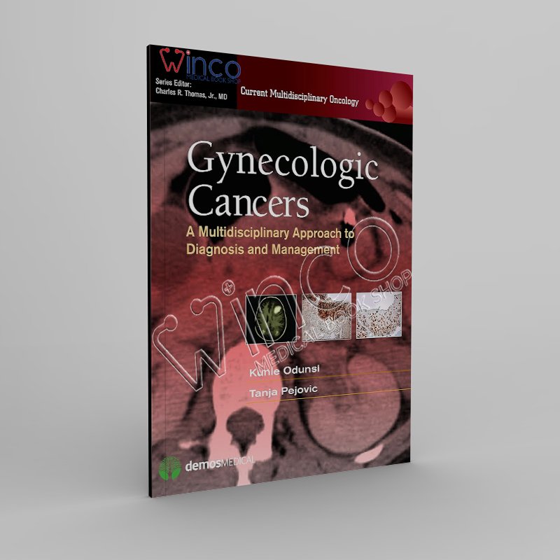 Gynecologic Cancers: A Multidisciplinary Approach to Diagnosis and ...