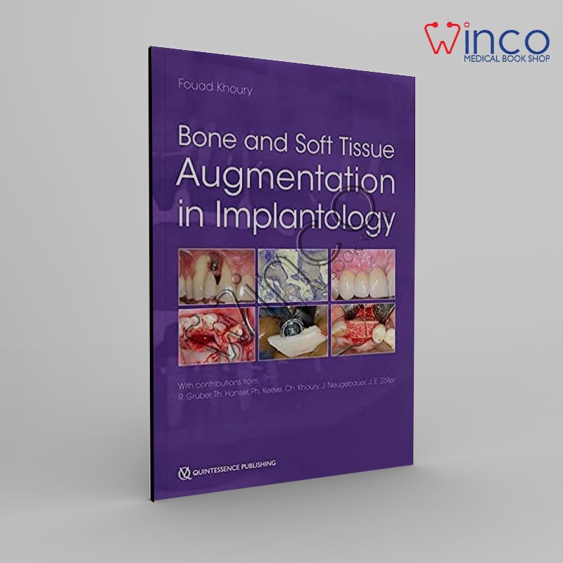 Bone and Soft Tissue Augmentation in Implantology 1st Edition - Winco ...